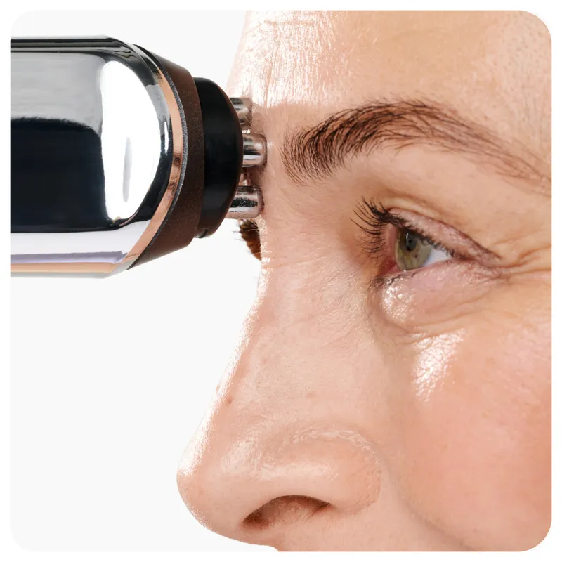 RF device being used on brow area