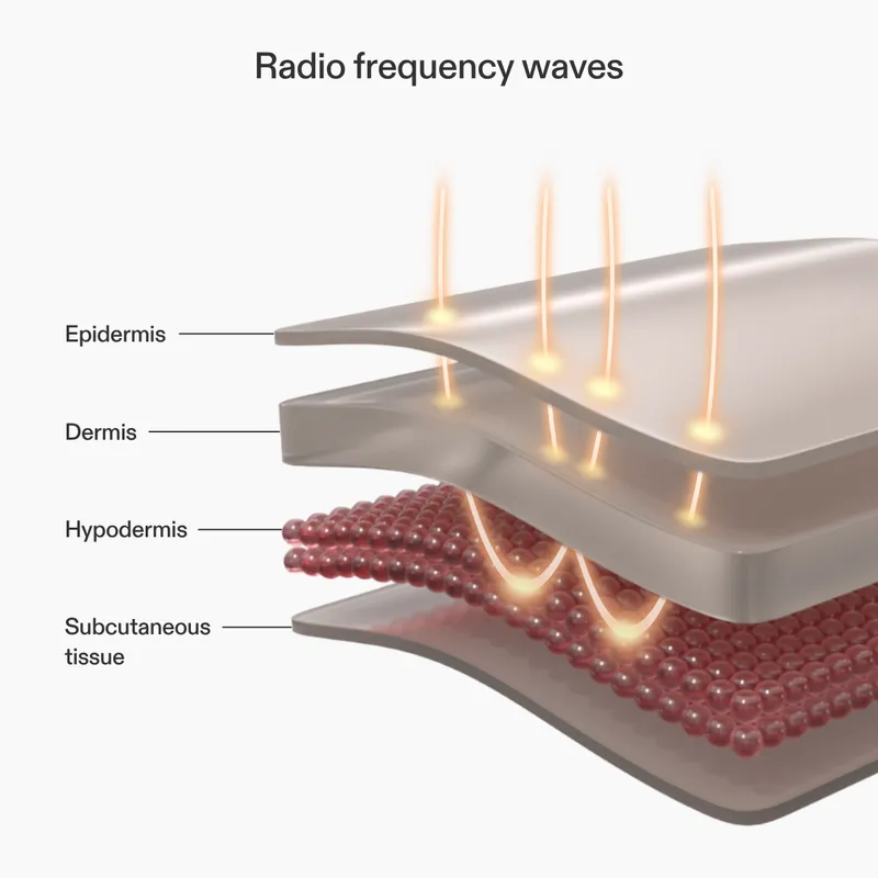 CurrentBody RF Radio Frequency Skin Tightening Device product image