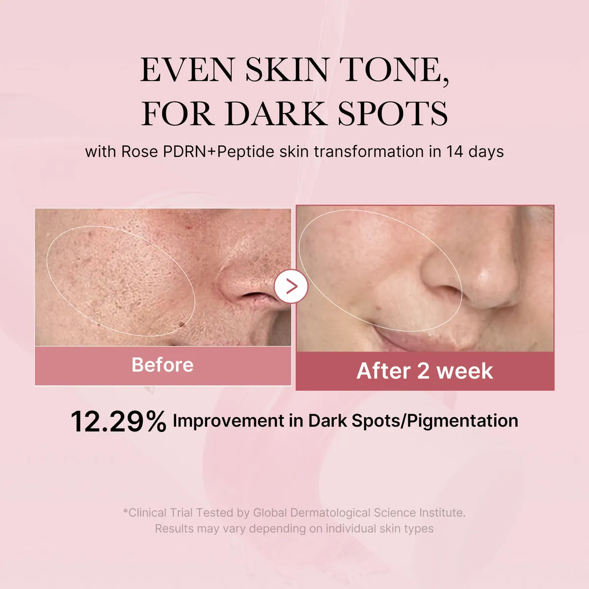 Medicube PDRN Pink Peptide Toner complete set product image