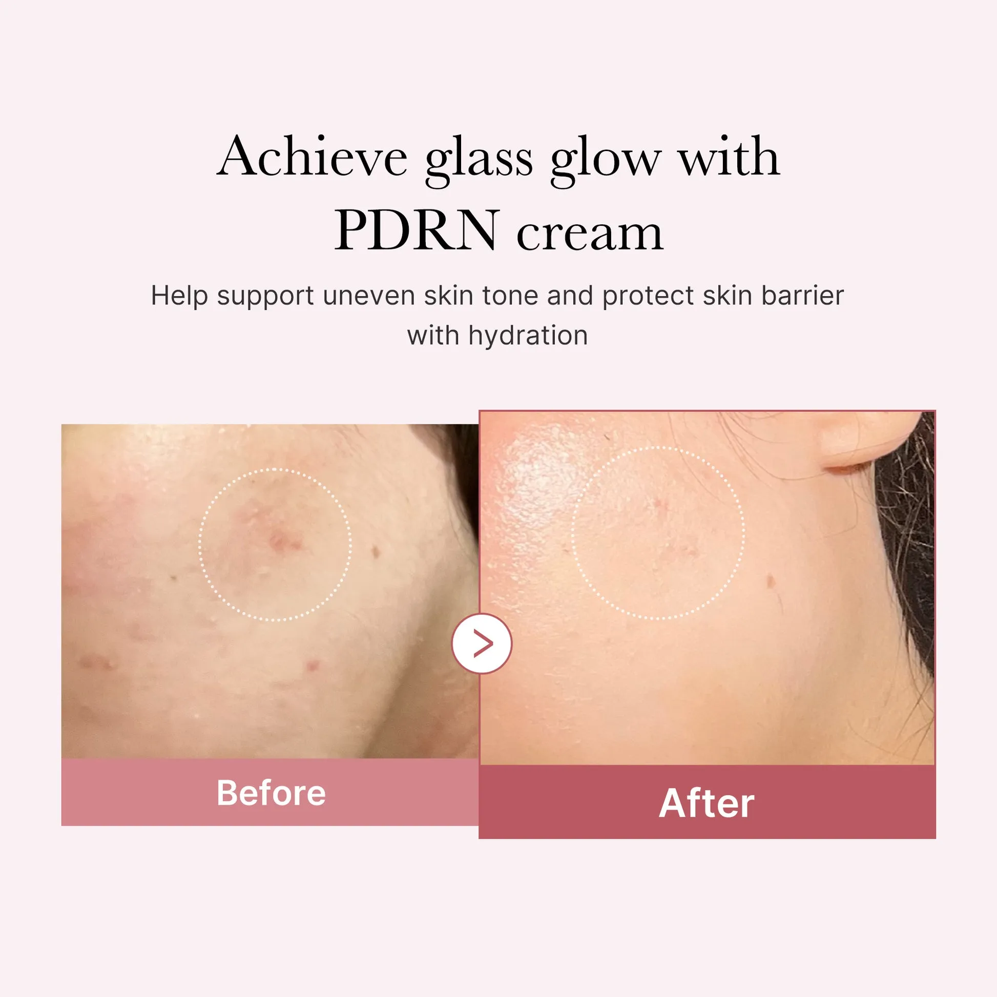 Medicube PDRN Pink Peptide Cream complete set product image