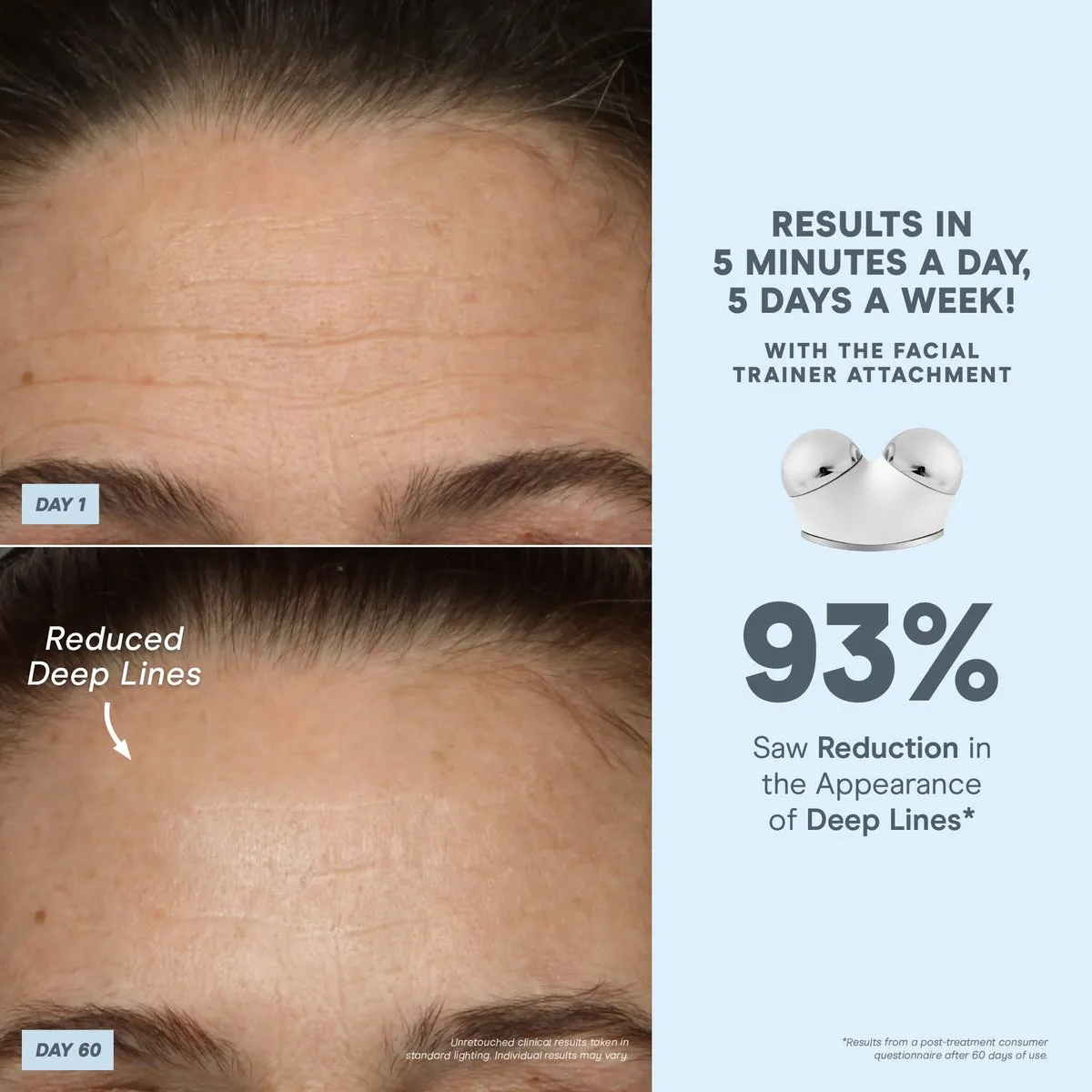 NuFACE TRINITY+ Complete Set 93 percent clinical results statistics graphic
