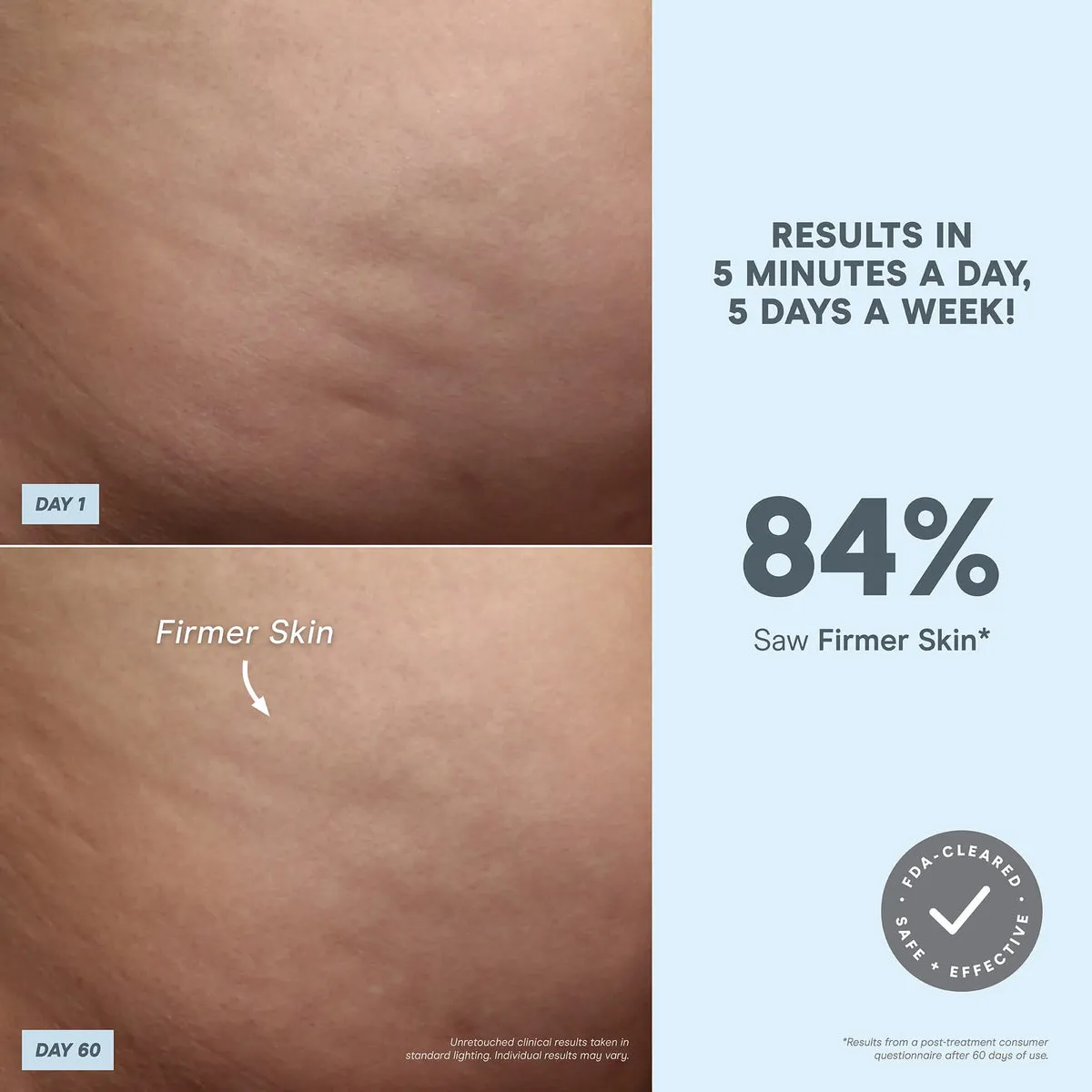 NuFACE NuBODY® 84 percent clinical results statistics graphic