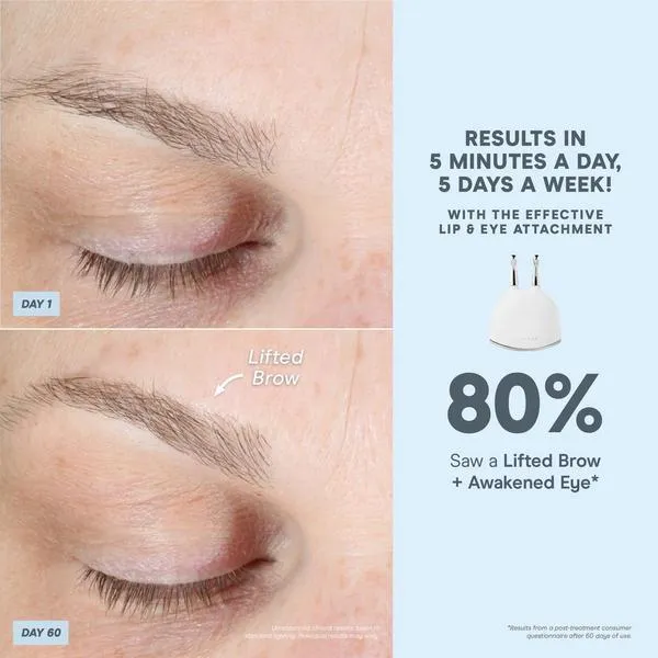 NuFACE TRINITY+ Effective Lip & Eye Attachment product image