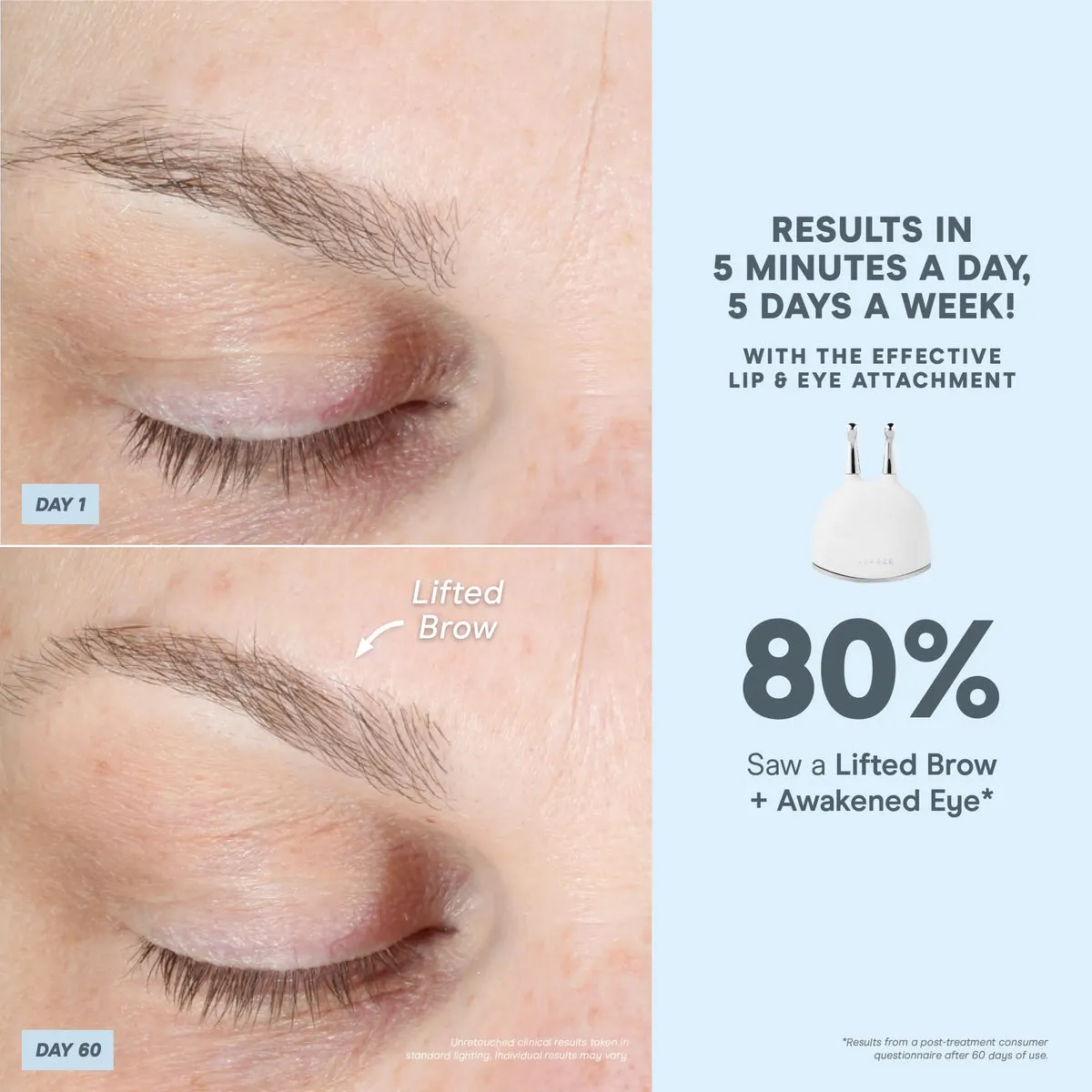 NuFACE TRINITY+ Effective Lip & Eye Attachment 80 percent clinical results statistics graphic